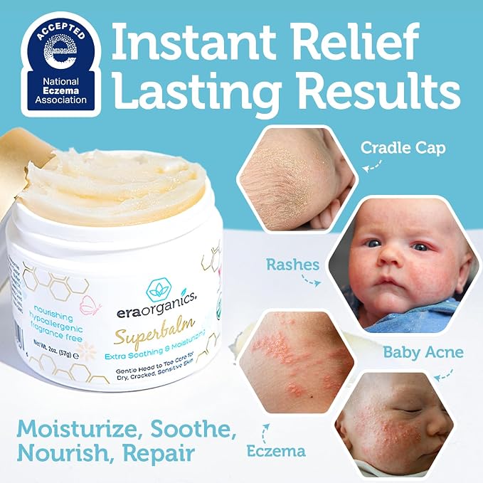 Era Organics Healing Ointment for Babies - Image 3