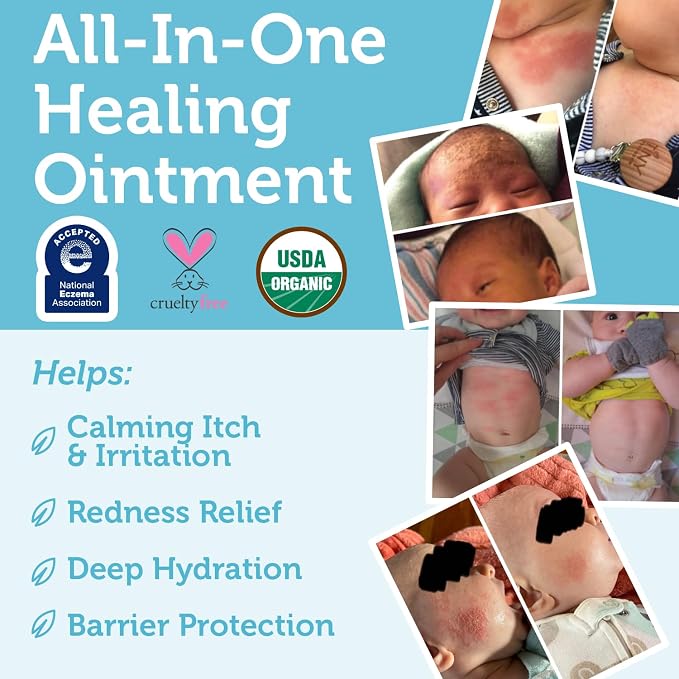 Era Organics Healing Ointment for Babies - Image 5