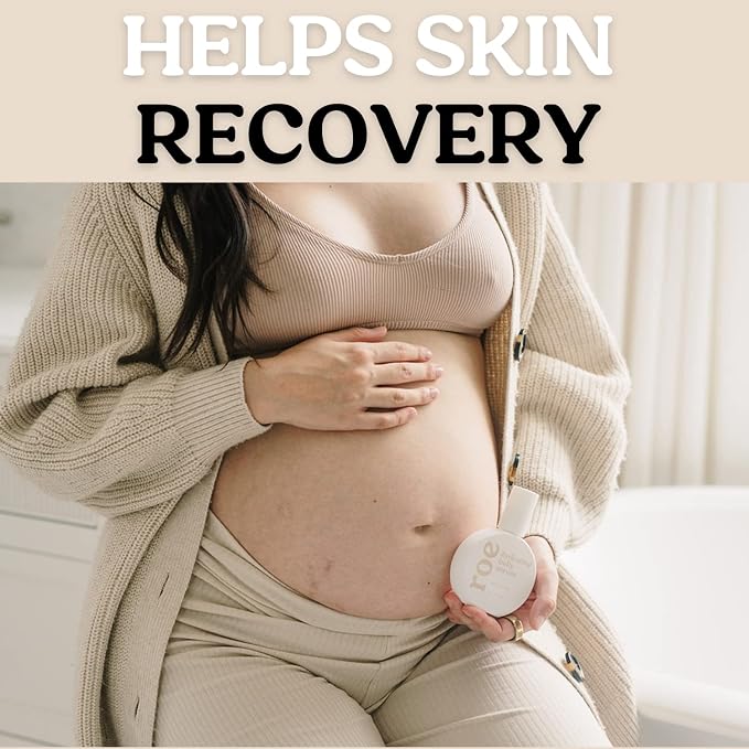 Roe Wellness Stretch Mark Belly Serum/Oil - Image 5
