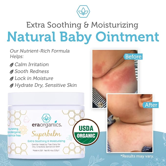 Era Organics Healing Ointment for Babies - Image 5
