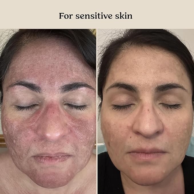 Roe Wellness Baby Cream & Baby Serum Power Pair Biome Barrier | - Image 4