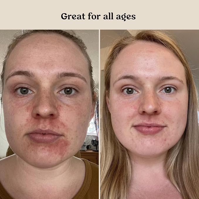 Roe Wellness- Baby Serum Hydrating Skincare EWG Verified Non-Toxic Ingredients - Image 7