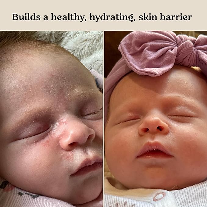Roe Wellness- Baby Serum Hydrating Skincare EWG Verified Non-Toxic Ingredients - Image 5